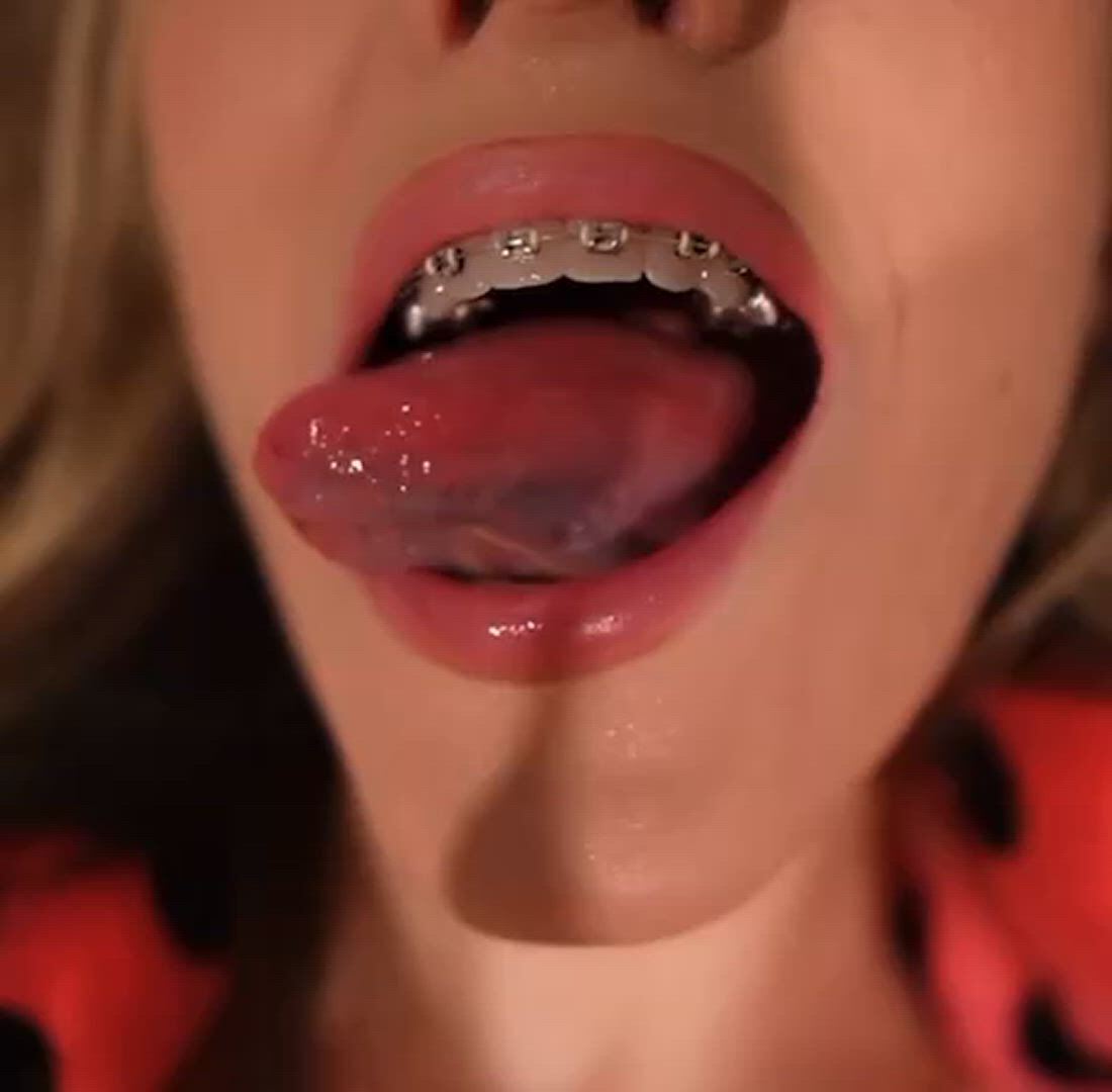 Braces porn video with onlyfans model andiexsocial <strong>@andie_x</strong>